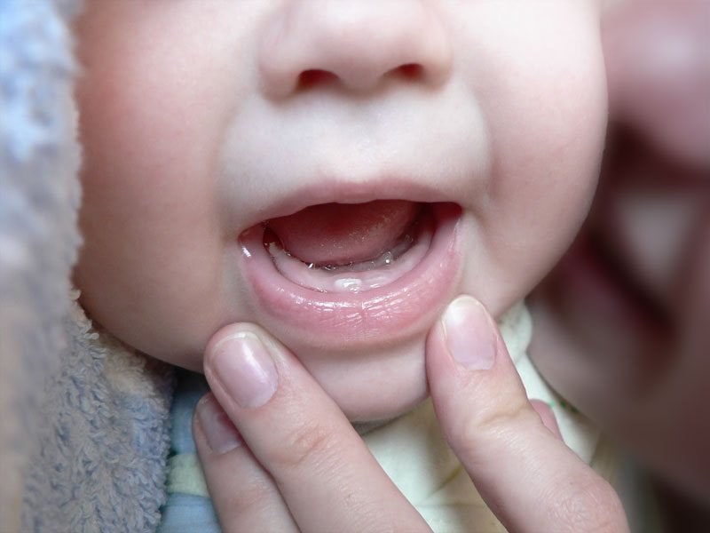 Последовательность прорезывания первых зубы у детей, сроки